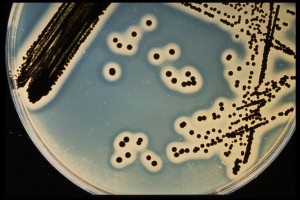 Staphylococcus aureus