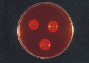 DERMATOPHYTE SELECTIVE CAF. AGAR 1