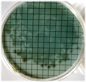 Pseudomonas aeruginosa en 48h