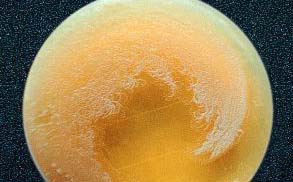 Bacillus anthracis en "melena de león"