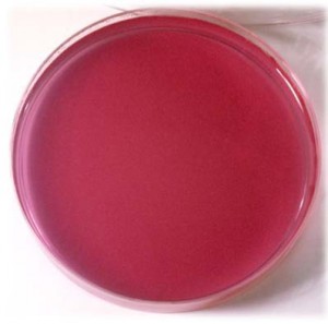 DTA, medio sin inocular, con su característico color púrpura