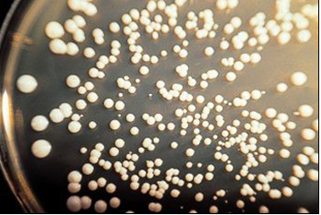 Sacharomyces cerevisiae