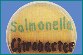 CHROMOSALM Agar Salmonella: colonias verde-azuladas falsos positivos de otros medios (Proteus, Citrobacter y demás enterobacterias): colonias negras o incoloras