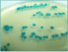 T.B.X. Agar E.coli: colonias verde-azuladas