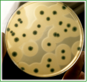 CHROMOCYTOGENES Agar Listeria monocytogenes: colonias verdes con halo, Rhamnosa positivas y Xylosa negativas