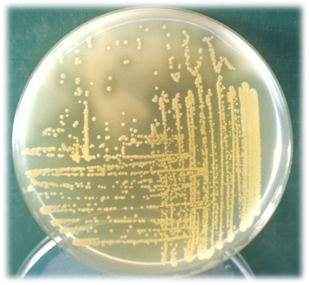 Staphylococcus aureus DNA-asa positivo (halo transparente tras unos minutos de añadir HCl en el cuadrante superior izquierdo)