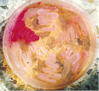 Serratia marcescens (a las 10), E.coli (a las 12, a las 2 y a las 6). Grupo KES (a las 4 y a las 8).