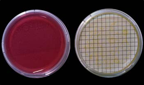 Manitol Salt Agar , rojo, con Staphylococcus aureus: colonias amarillas con gran halo amarillo del medio que inicialmente era rojo.