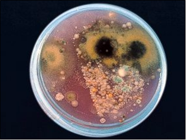 Recuentos ambientales mucho más sensibles y con muy superior diversidad de especies que los medios clásicos de recuento total.