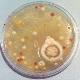 Recuento ambiental en el medio sin púrpura