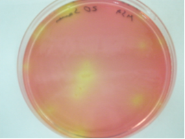 Staphylococcus aureus: colonias amarillas con gran halo de viraje a amarillo del medio rojo.