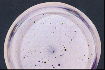 Coliformes fecales (incl.E.coli): colonias azules.