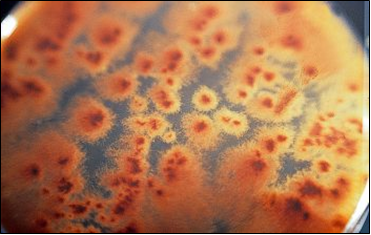 Botrytis cinerea (vista por debajo), alterativo de fresas y uvas y productor del vino noble.