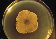 Alternaria alternata, patógena de claveles, alergénica