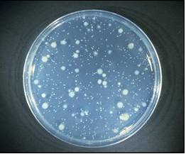 Recuento total por siembra en masa.