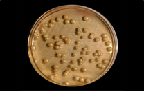 Sacharomyces cerevisiae, levadura del pan, cerveza, vino…