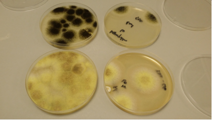 Arriba: A.niger esporulado (negro) en 3 días en SDA. Abajo, el mismo en SDA+Caf, todavía iniciando su esporulación, en el mismo tiempo y temperatura de incubación
