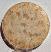 Rhodotorula glutinis (rosa) y Penicillium candidum (blanco) vistos por debajo.