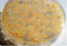 Flora mixta de levaduras y mohos, vista desde abajo.