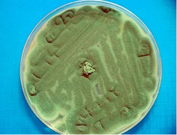 Aspergillus fumigatus, patógeno oportunista, en PDA