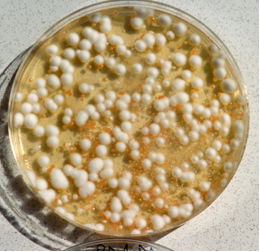 Penicillium candidum (blanco) útil para pintado de embutidos y Rhodotorula glutinis (rosa), la levadura pastelera.